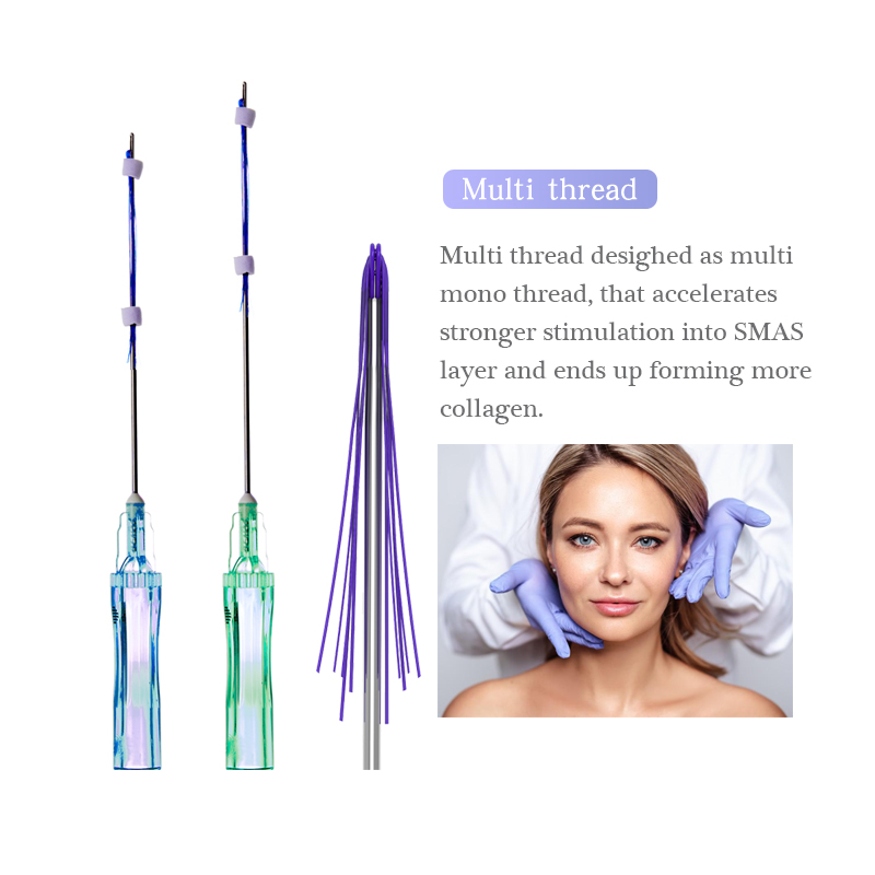 PDO Multi Threads for Glabella Forehead Nasolabial Folds Lifting