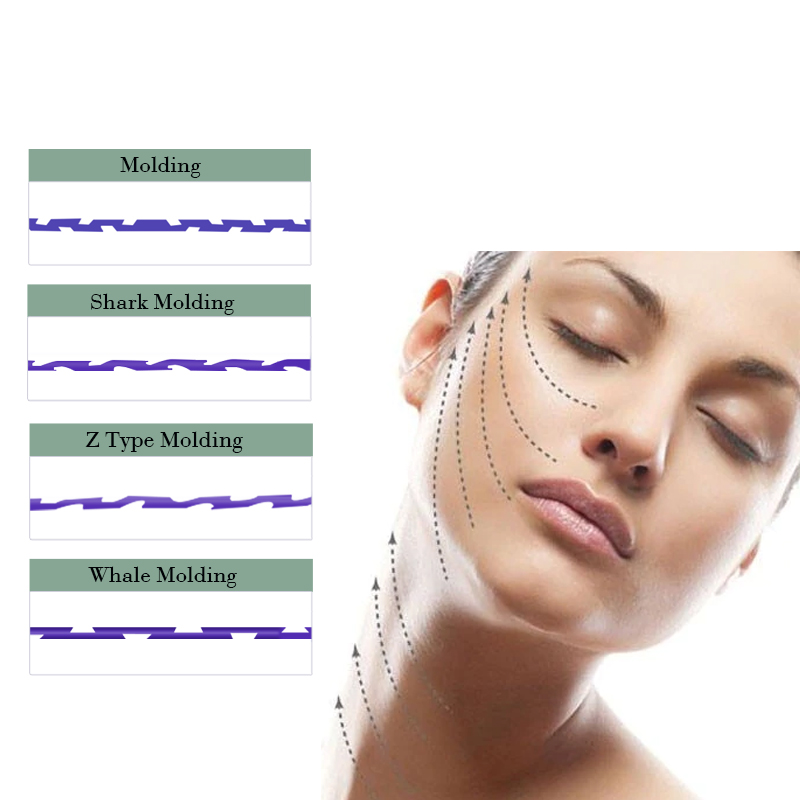 PDO Molding Threads Z Type Shark Molding 18G 100MM