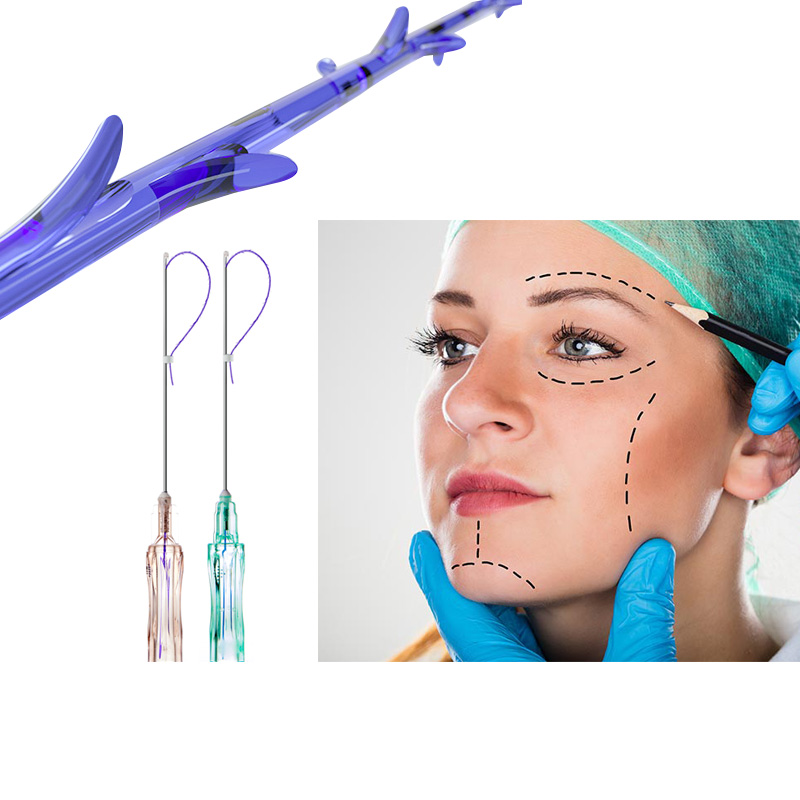 Natural Contouring with Deenora PDO Threads